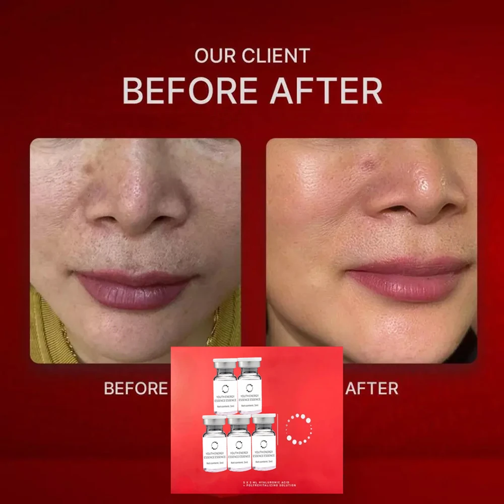 135Pink nctf hyaluronic acid essence repair skin firming moisturizing essence New version square box 3ml Facial brightening