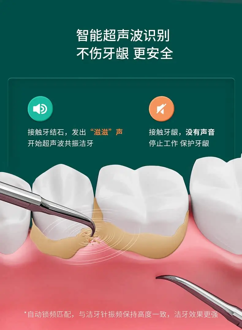 T-flash Scaler ล้ำเสียง J1อุปกรณ์ล้างฟันที่ใช้ในครัวเรือนสำหรับการกำจัดหินฟันและสิ่งสกปรกทำความสะอาดทางทันตกรรม