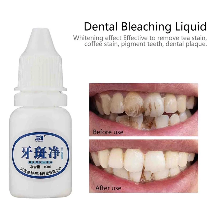 Hot Sale 2021 Teeth Colour Corrector Teeth Whitening Toothpaste Liquid Type Whitener Teeth Teeth Colour Corrector for Oral Care