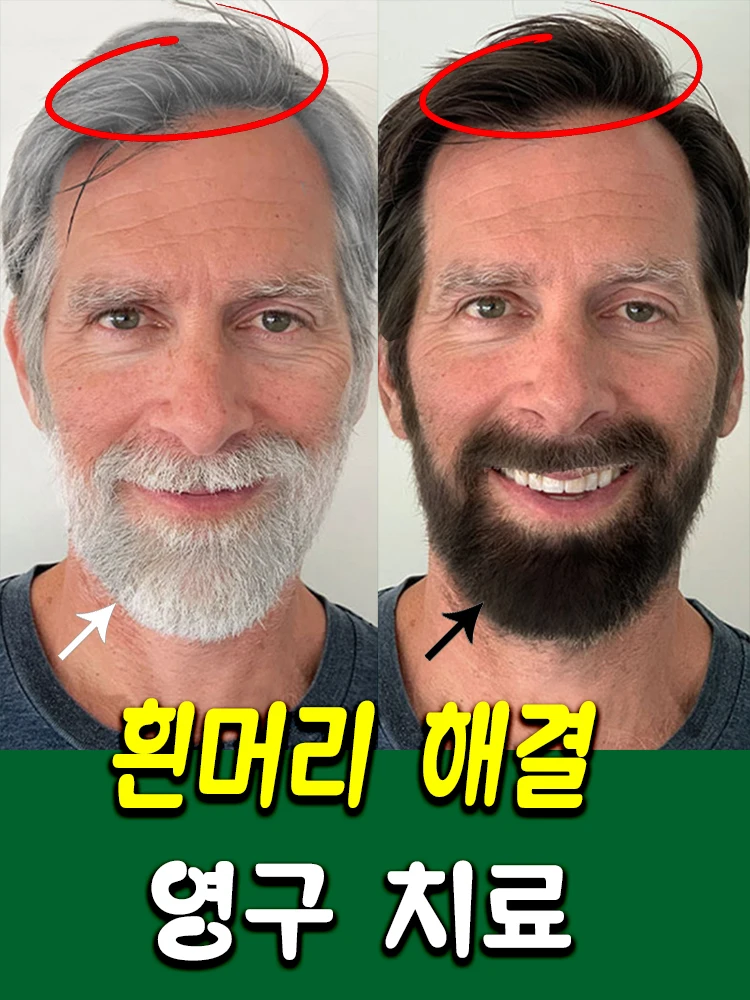 안티 그레이 헤어 에센스 세럼 트리트먼트, 자연스러운 헤어 컬러 복원, 건강한 화이트에서 블랙 헤어 복원  Best5