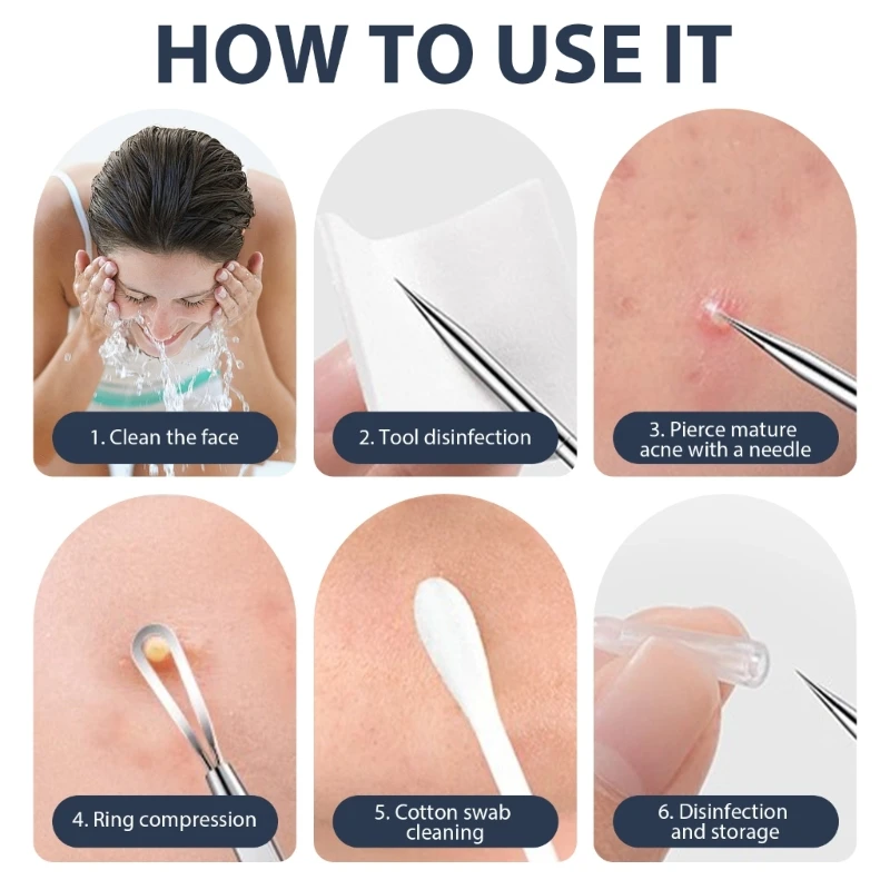 9 قطعة أداة إزالة الرؤوس السوداء الفولاذ المقاوم للصدأ مجموعة أدوات بثرة إزالة الرؤوس السوداء دروبشيبينغ