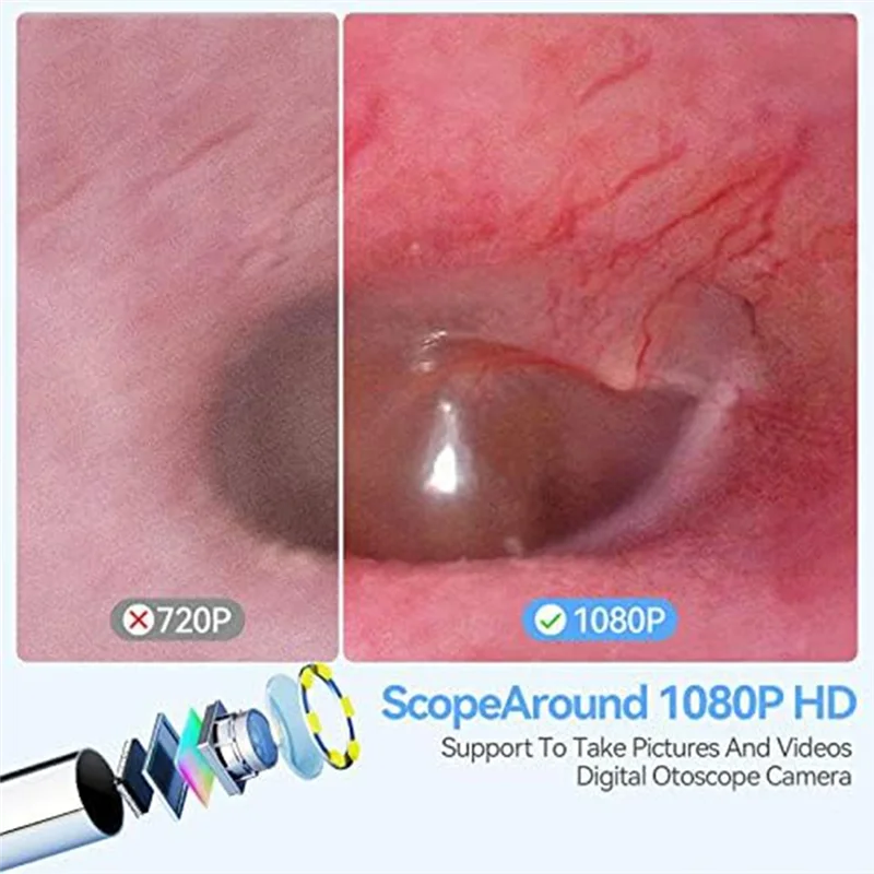 Caméra d'oreille Otoscope avec écran de 4.5 pouces, nettoyeur d'oreille intelligent, cuillère d'oreille visuelle avec Kit d'outils de caméra, caméra de nettoyage d'oreille Durable