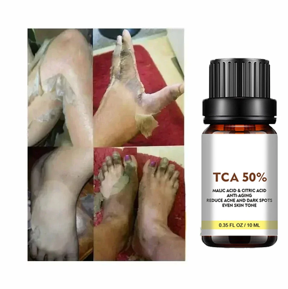 Рисунок 4 - Пилинг для лица с салициловой кислотой