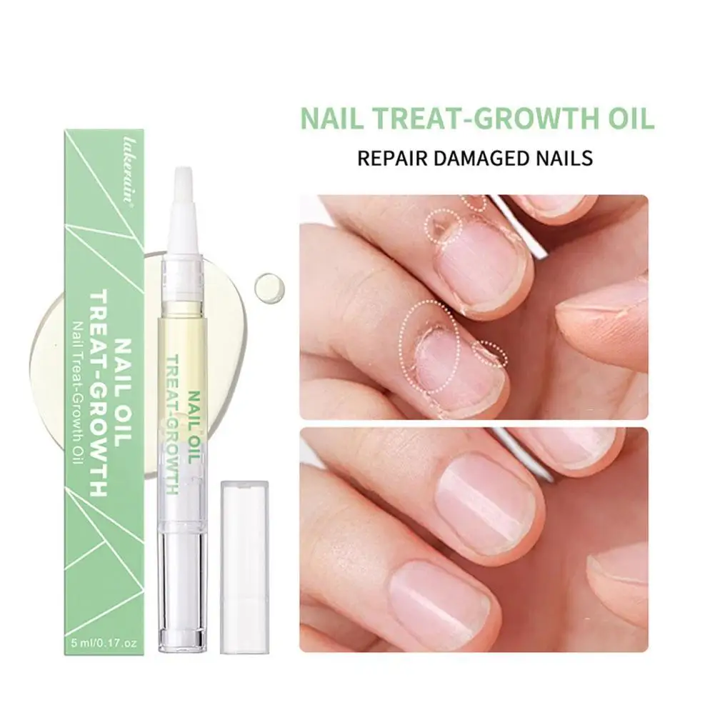 Nail Nutrition Oil Pen Nail Strengthener for Thin Nails And Growth Nail Treatment Cuticle Revitalizer Oil Prevent Agnail Nourish