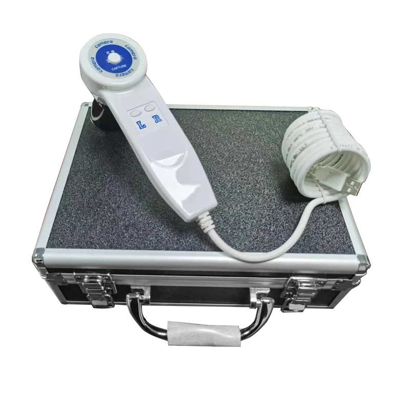 Hot selling iriscope iris analyzer iridology camera with pro iris software