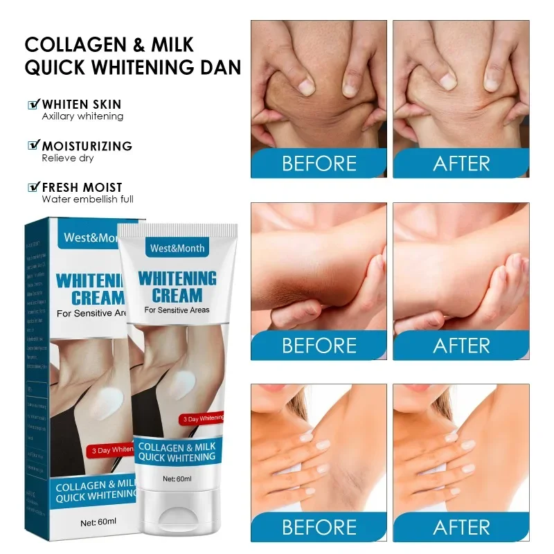 Whitening Cream Private Parts Underarm Bleaching Serum Whiten Butt Knee Brighten Inner Thigh Intimate Parts Dark Remove Melanin