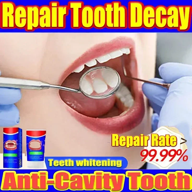 

Repair All Tooth Decay Cavities and Protect Teeth Tooth Decay RepairWhitening Teeth Dental Lab Dental Caries Decayed Teeth