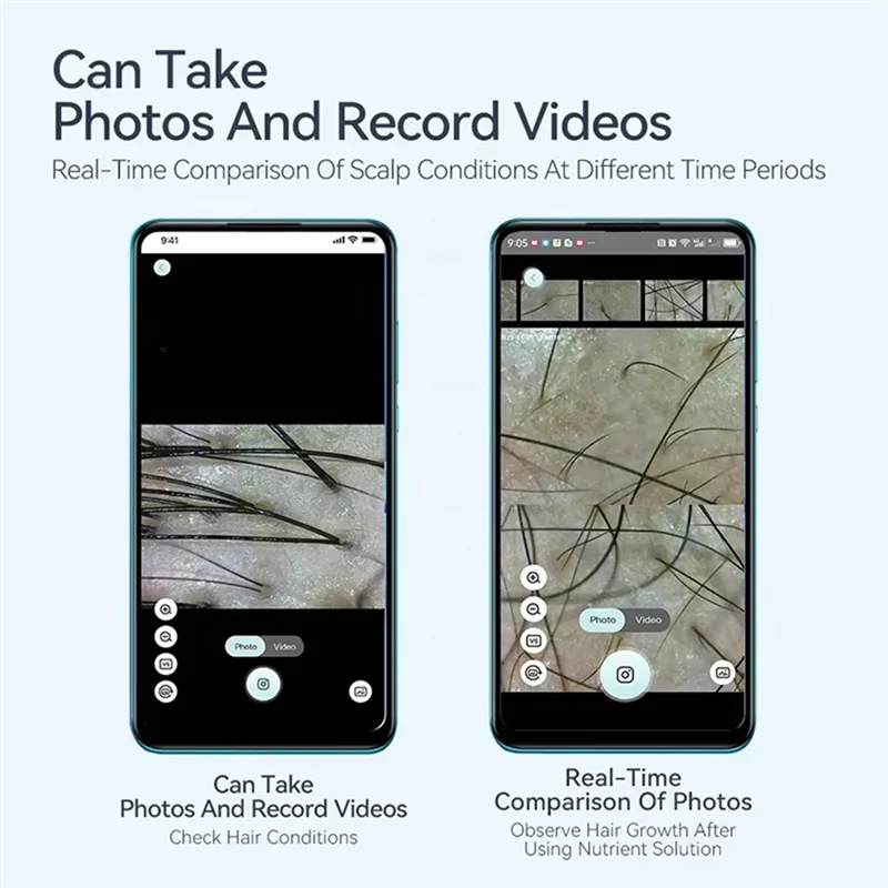 YCOC-頭皮カメラ検出プロフェッショナル顔肌分析機デジタル顕微鏡毛穴拡大鏡