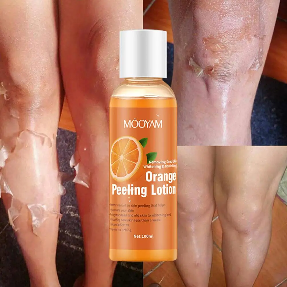 Loção Peeling Laranja para Remoção de Pele Morta Clareamento da Pele, Loção Branqueadora, Suavização Corporal, Esfoliante Str P8J1, 100ml