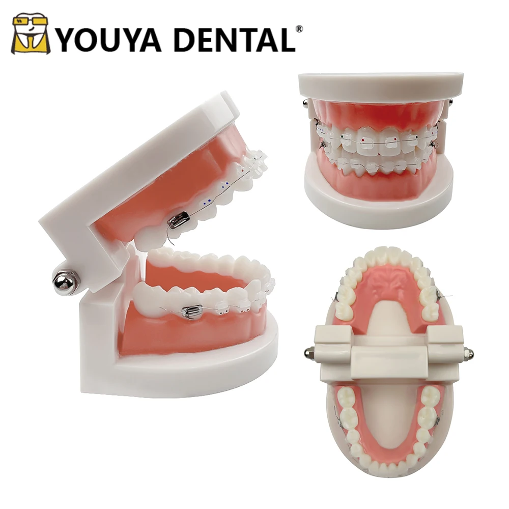 

Teeth Model with Orthodontic Dental Teaching Model For Dentist Studying Practice Demonstrate Doctor-patient Communication Tools