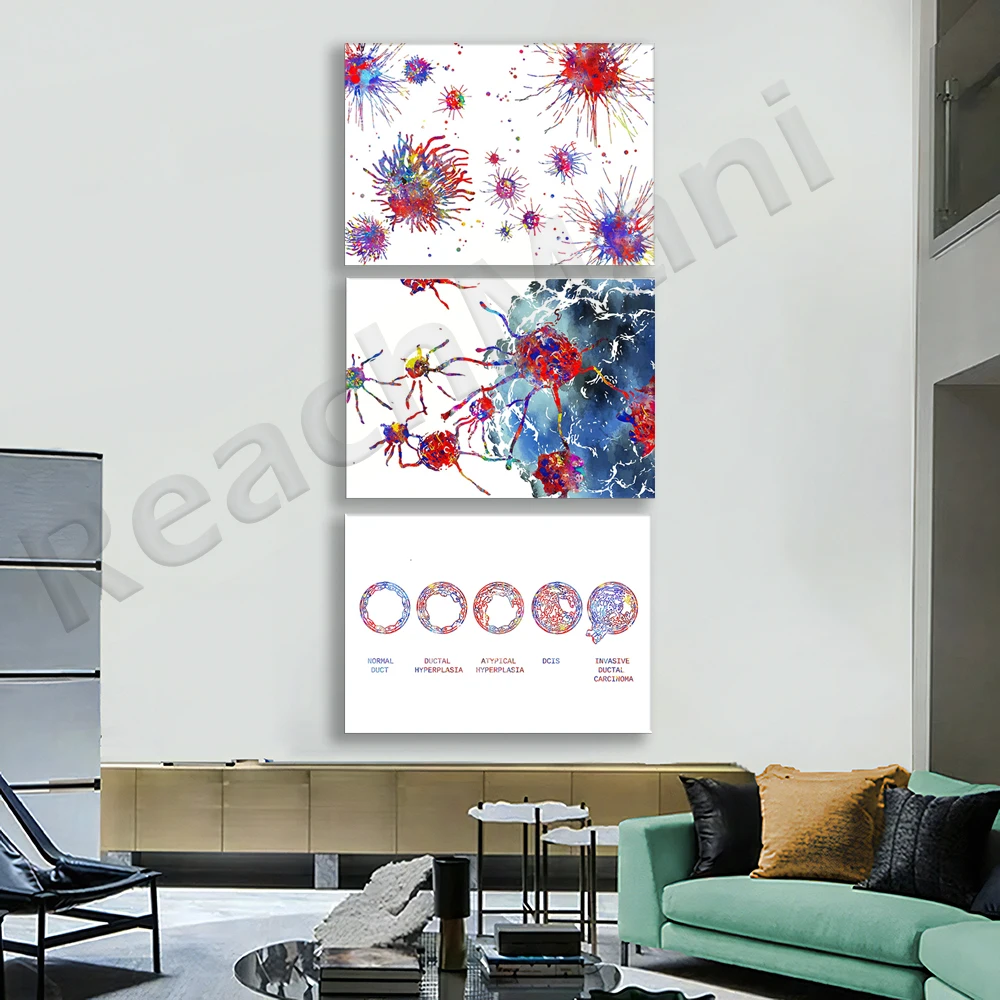 Cancer cells, prostate cancer cells, normal breast cancer and breast cancer types anatomy breast biology art poster, medical gif