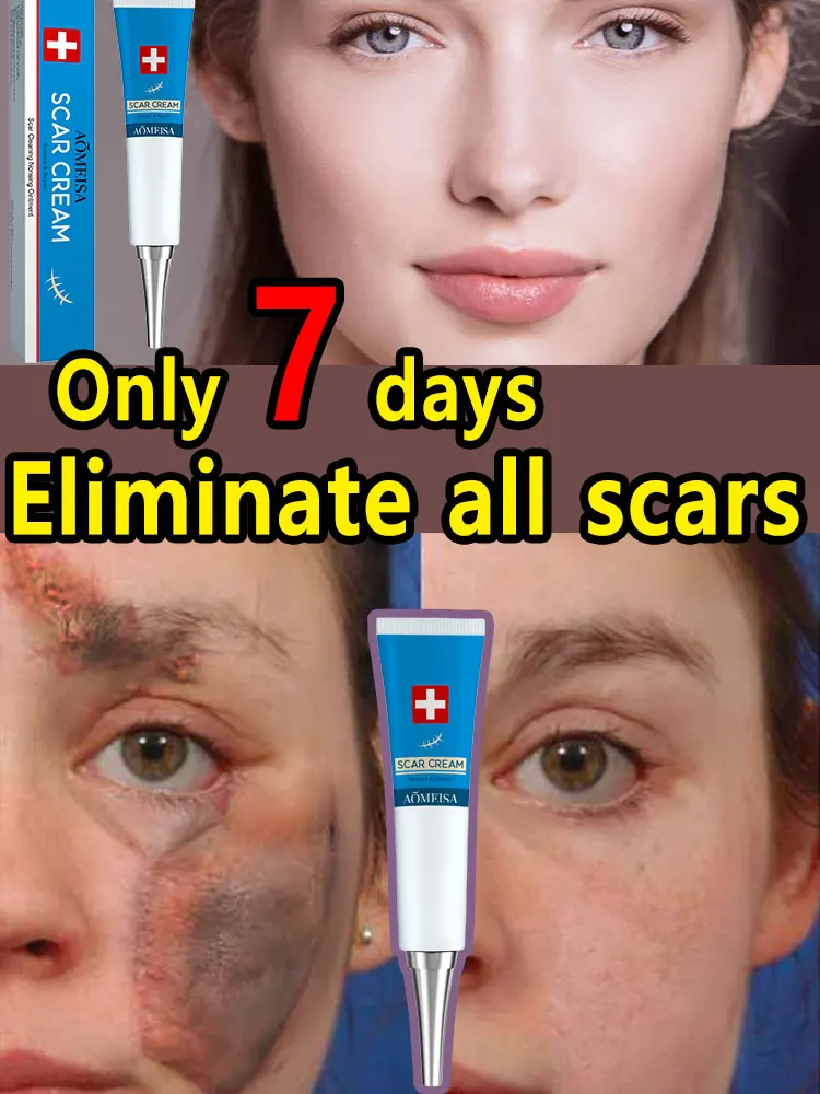 Make scars a thing of the past