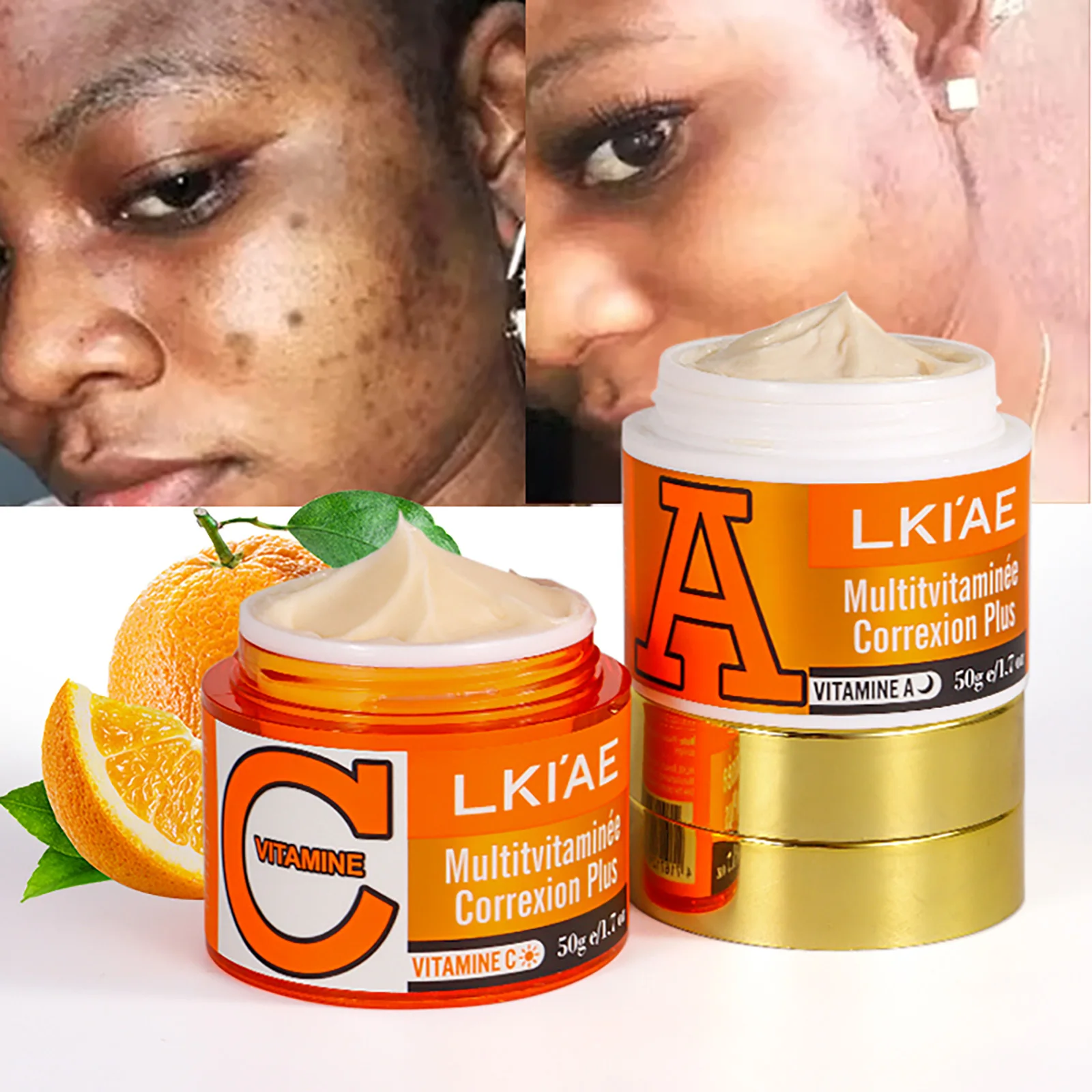 كريم تبييض الوجه للفيتامينات C والفيتامينات، يقلل من البقع الداكنة، كريم الوجه النهاري والليل لجميع أنواع البشرة #1