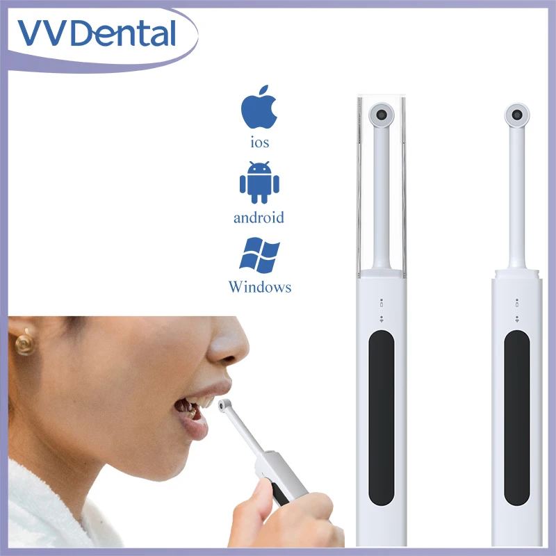 Беспроводная стоматологическая внутриротовая камера VVDental, 300 Вт пикселей, видео высокой четкости, оральный эндоскоп, стоматологическое внутриротовое зеркало Беспроводная стоматологическая внутриротовая камера VVDental, 300 Вт пикселей, видео высокой четкости, оральный эндоскоп, стоматологическое внутриротовое зеркало
