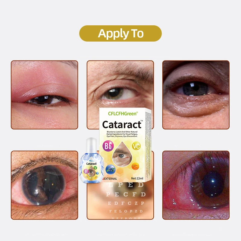 Cataract Cure Vitamin B6 Eye Drops Blurred Vision Treatment Black Shadow Cloudy Eyeball Removal 12Ml