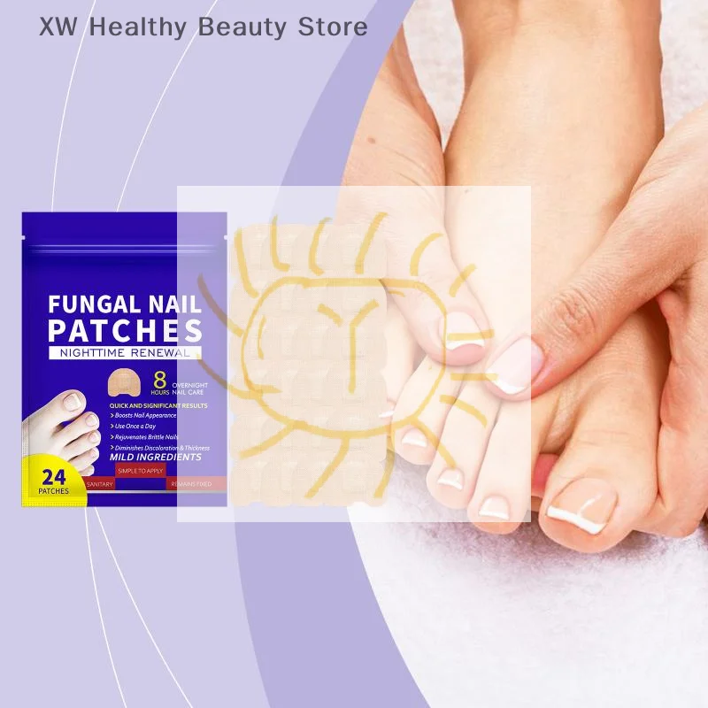 Nail Repair Patches Toenail Fungus Patch Sticky Toenail Care Nail Ingrown Correction Sticker Paronychia Nail Treatment Patch
