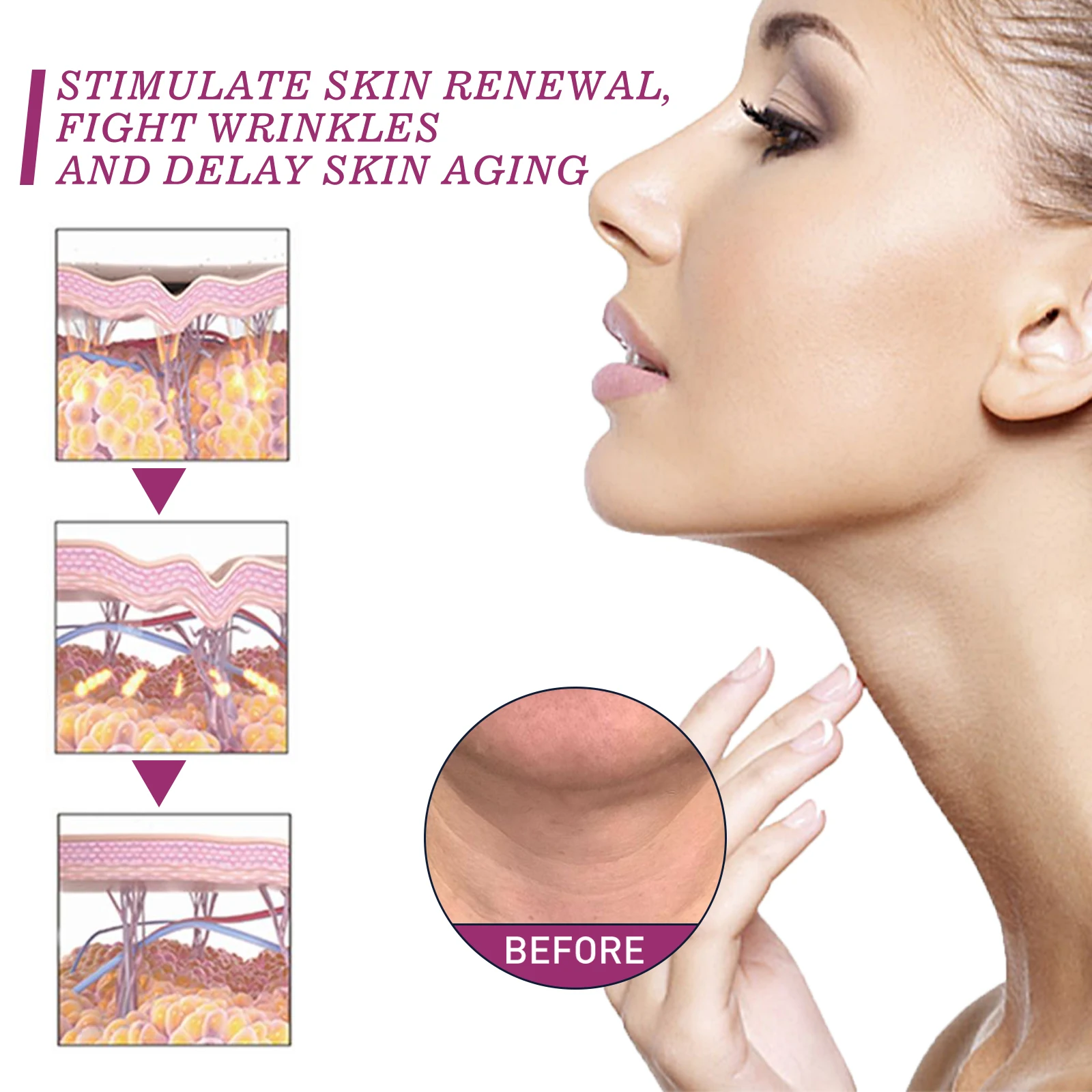 Neck Lines Protein Cream Collagen Eliminate Neck Fine Lines Anti-Ageing Lift Remove Double Chin Rejuvenation Cream Skincare New