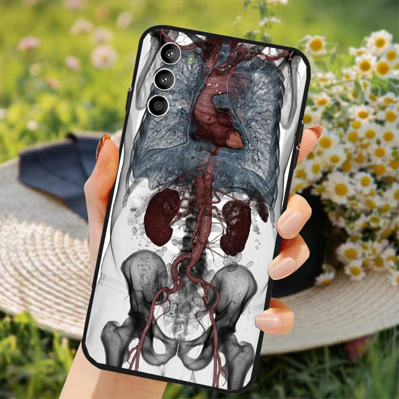 Human Organs Skeleton Skull Brain Case For Moto G84 G22 G32 G34 G52 G10 G20 G30 G60 G60S G13 G50 G54 G62 G53 G72 G85 G24 Power