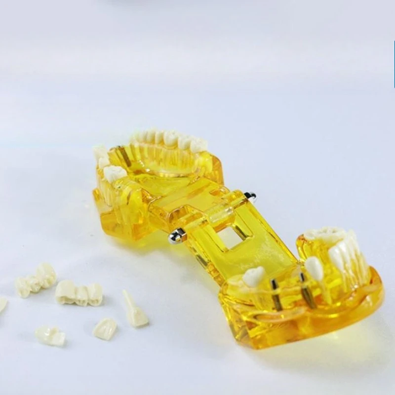 2Pcs Dental Models Removable And Restorable Models Of Diseased Teeth For Teaching And Researching Medical And Dental Diseases