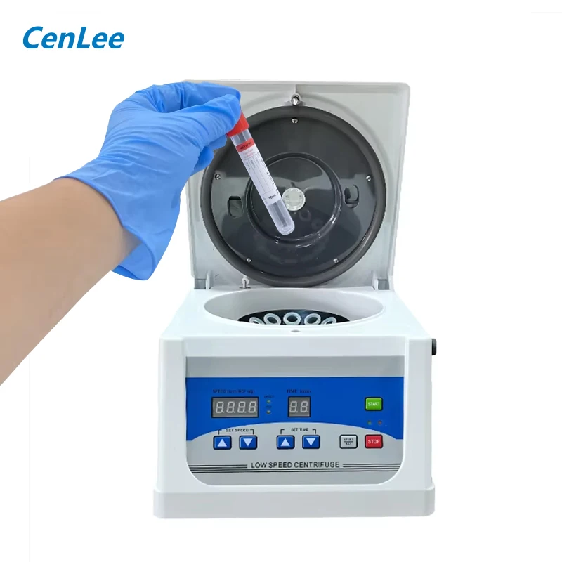 PRF APRF CGF PR مختبر الطرد المركزي 4000 دورة في الدقيقة حامل أنبوب فراغ لفصل مصل الدم أداة تشخيص الفصد #1