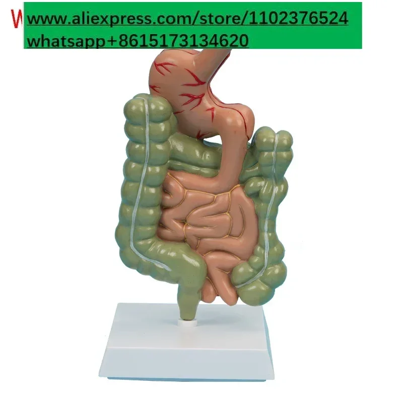 Pathological digestive system model, medical display teaching explanation popular science