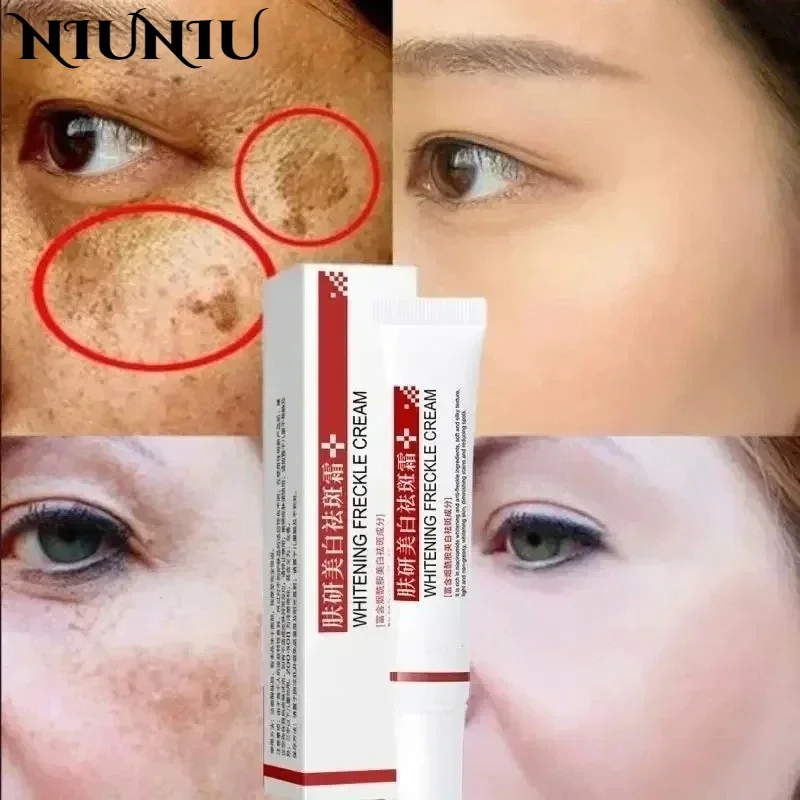 Fade Melasma Dark Skin Body Creams Brighten Skin Moisturizing Skin Care Delicate Clean Pores Fade Pigmentation Face Care Creams