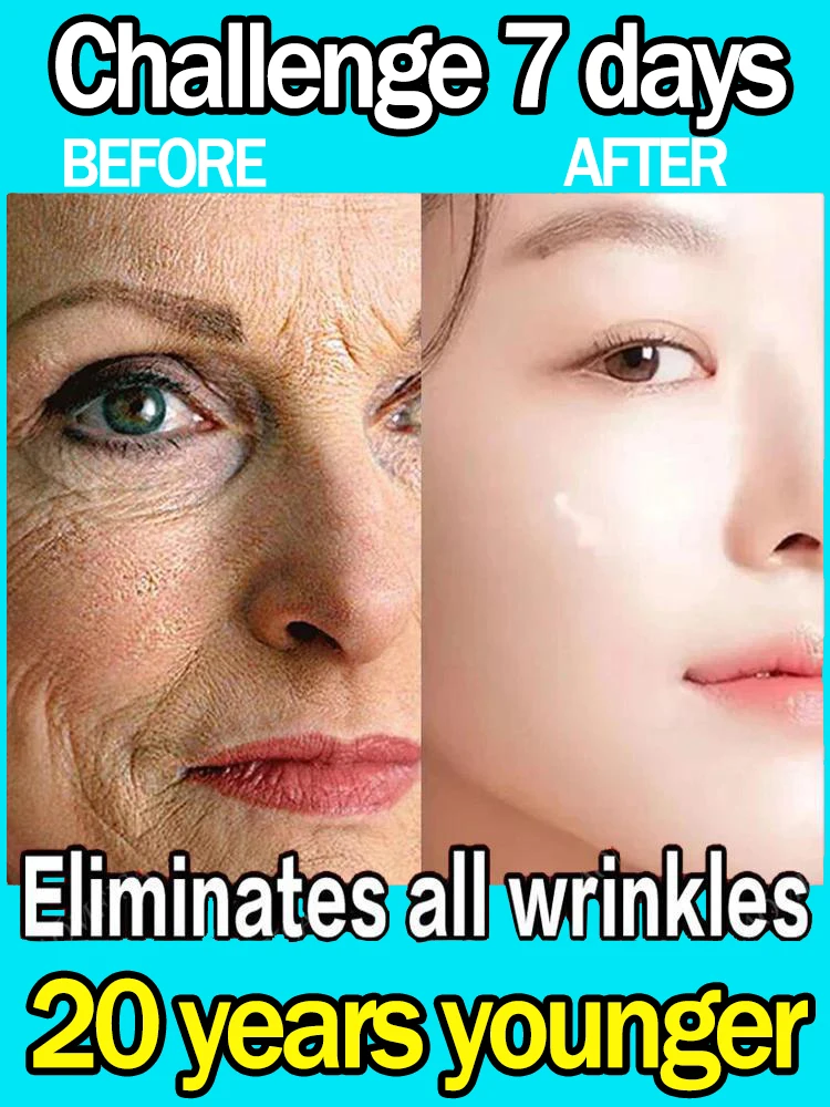 2023 New Upgrade Wrinkle Removal Serum Anti-aging Fade Fine Line Firm Lift Whitening Freckle Sensitive Skin Repair For Women Men