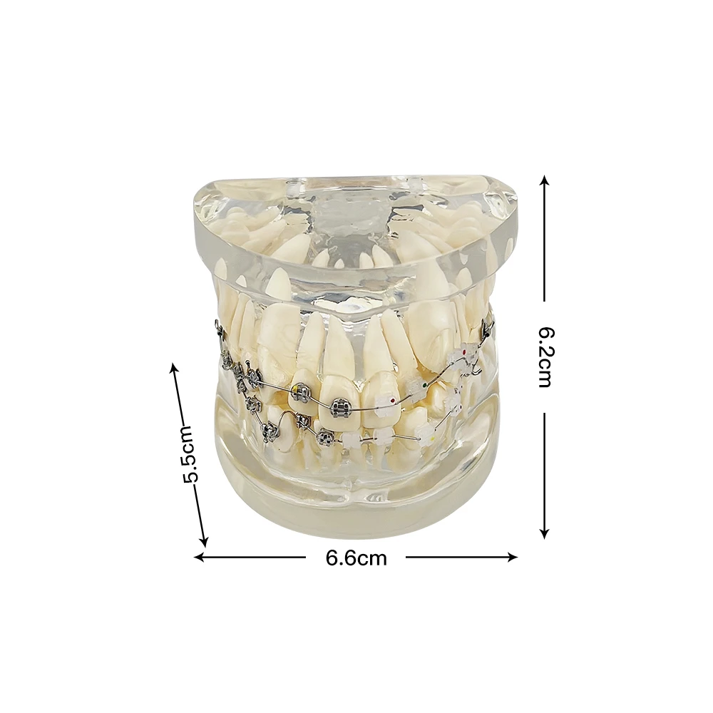 Dental Orthodontic Model Resin Teeth Model Ortho Treatment Model For Patient Communication Dentist Student Teaching Study Models