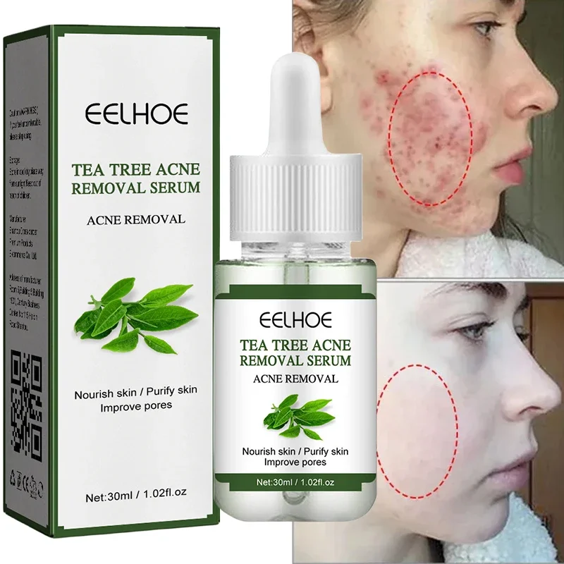 

Tea Tree Face Serum Acne Treatment Pore Shrinking Pimple Remover Whitening Deep Cleaning Moisturizing Korean Face Skin Care 30ml