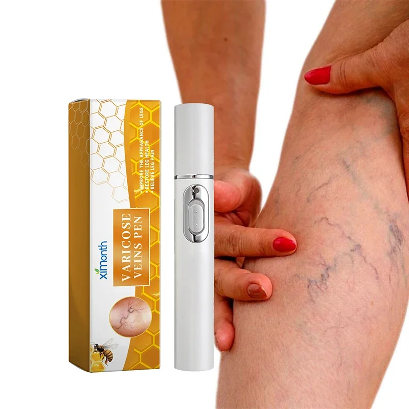 Leg Repair Pen Laser Treatment Improve Blood Circulation Varicose Veins Relieve Leg Swelling Discomfort Leg Skin Care Tool