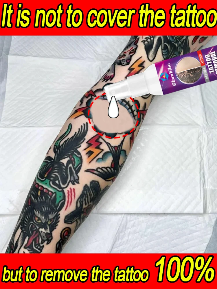 

Tattoo Killer, легко снимается все виды татуировок