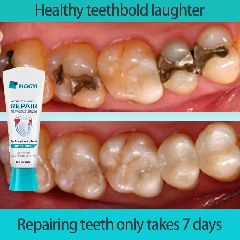 Oral health ensures white and clean teeth.We are very professional in oral health.