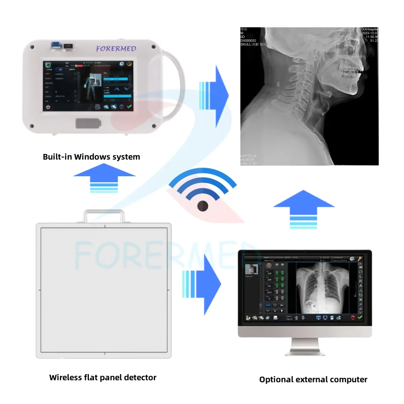 Hospital Clinical XRay Machine DR Flat Panel Detector X-ray Radiology Equipment 2024 New Digital Handheld X Ray Machine