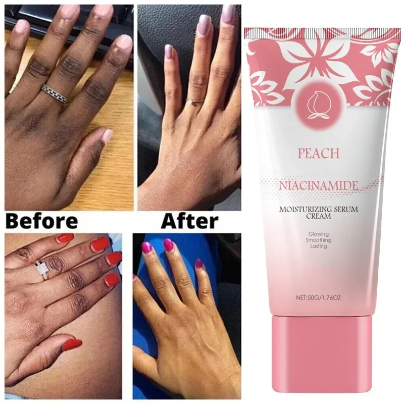 Niacinamide Powerful Brightening Cream Body Dark Skin Quickly Lightening Emulsion Women Facial Brighten Cream Korean Skin Care