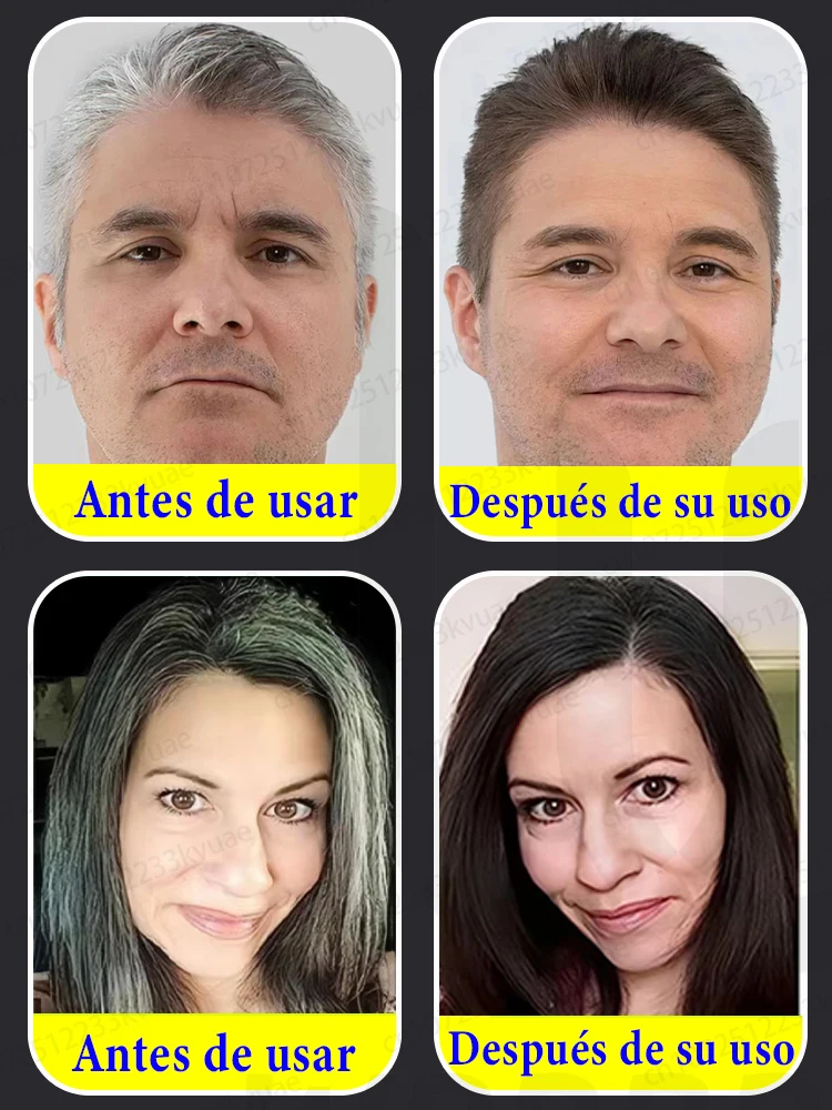 Imagen 3: Extractos anti-blanqueamiento naturales puros para eliminar las canas y convertirlas en cabello negro desde la raíz.