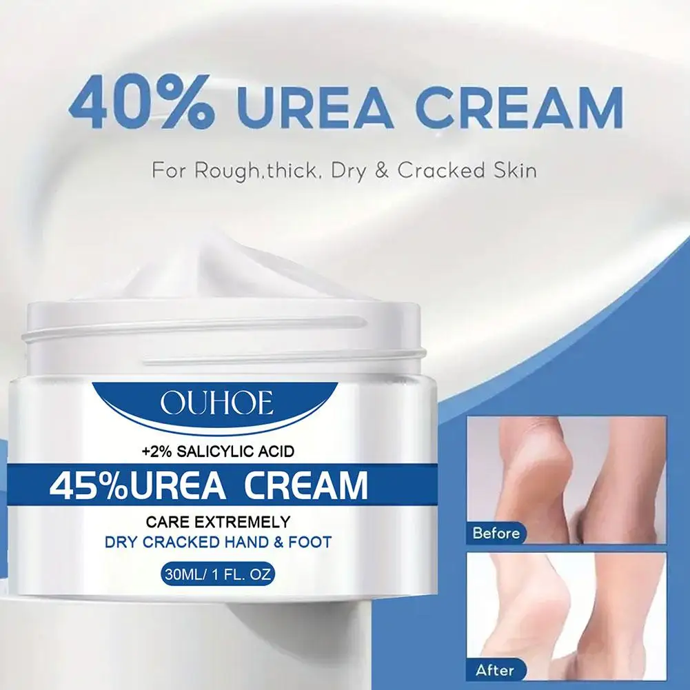 OUHOE 45% Urea Cream Feet Callus Remove Cream Body Repairing Cream Nourishing Moisturizing Exfoliation