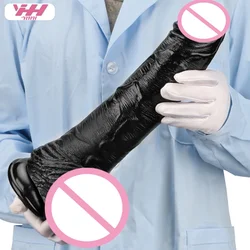 Black Super Big Huge Dildos with Suction Cup Huge Penis Thick Phallus Anal Plug Big Dick Sex Toys for Women Vaginal Masturbators