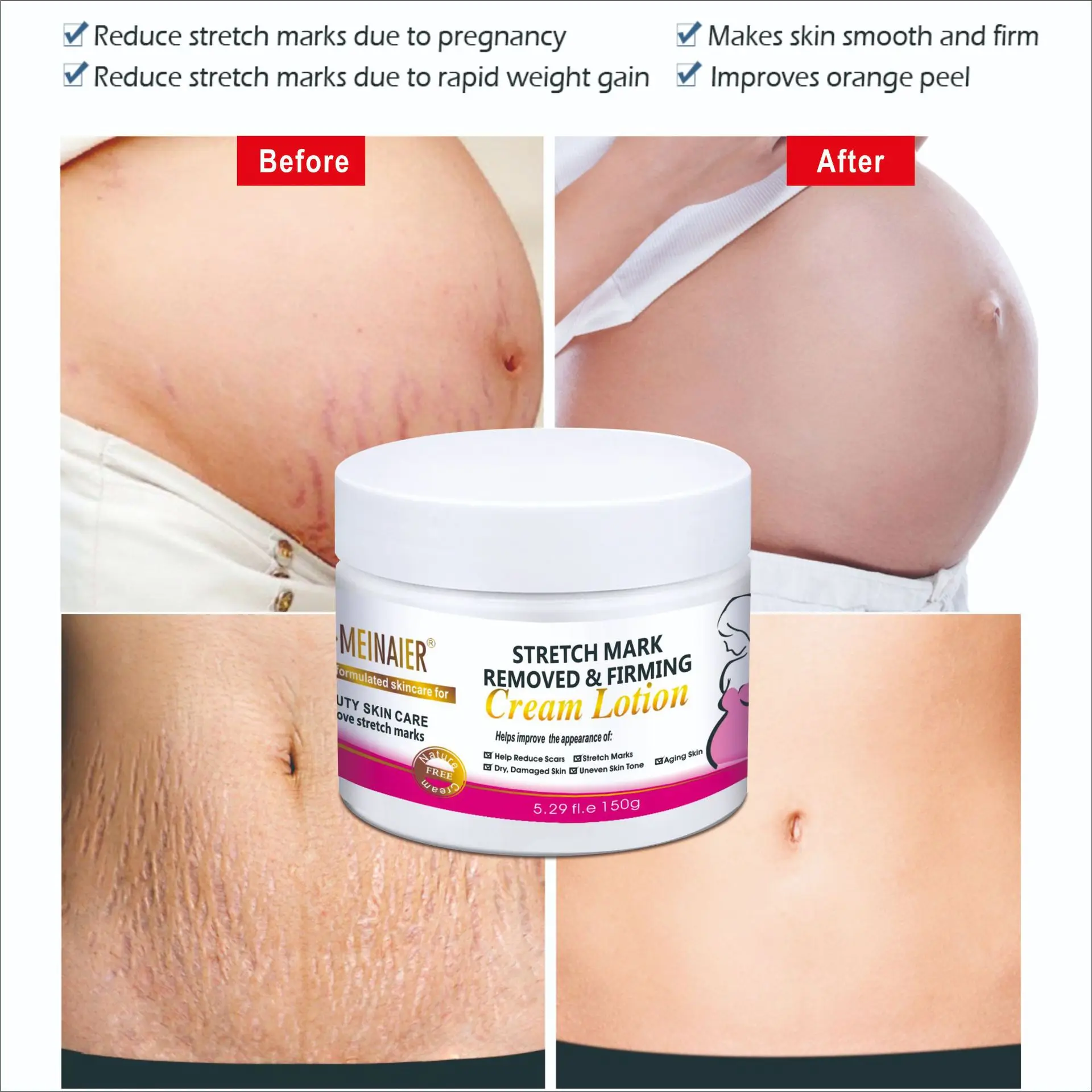 

Moisturizing Pregnancy Pattern Repair Prevention Reducing Stretching Pregnant Women Fat lines Repair Firming Cream Skincare