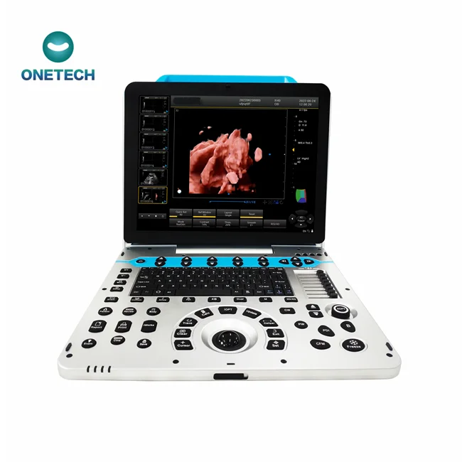 Рисунок 3 - C57 Высококачественная ультразвуковая