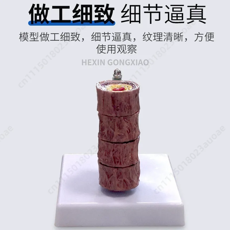 Human Blood Vessel Atherosclerosis Thrombus Model, Cardiovascular Artery Model, General Teaching Tool for Cardiology Education