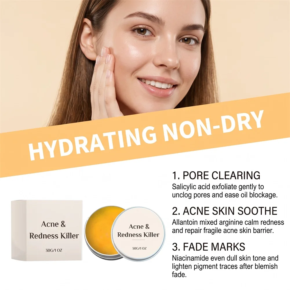 30g Acnes Redness Killer Fast-Acting Soothing Spot Treatments Blemish Cream Instantly Reduces Redness Clears Breakouts For Skin