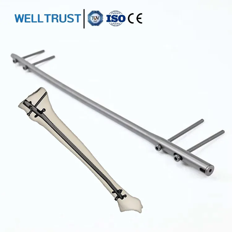 Wholesale Price Intramedullary Nail For Trauma Fracture Tibial Interlocking Nail Set With Customized Matching Instrument Kit