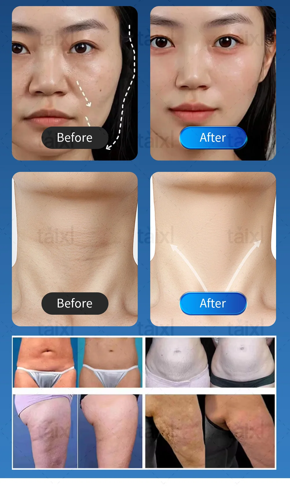 Professional Morpheus 8 RF Microneedling Machine Anti‑Aging Facial Skin Care Beauty Tool With 12 24 40 Nano Pin Cartridge.