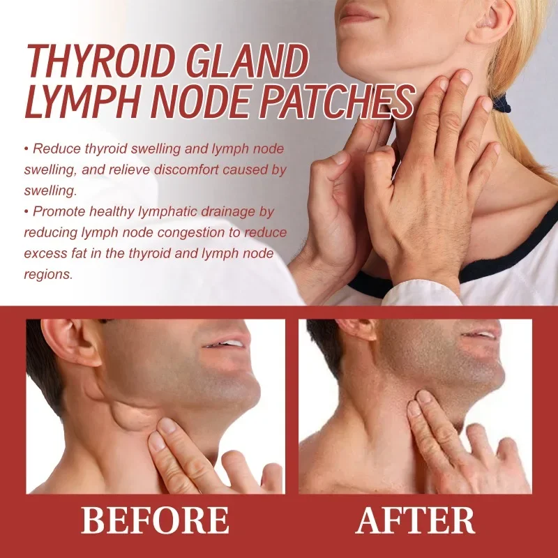 Thyroid Nodule Plaster Hyperthyroid Treatment Goiter Discomfort Nodule Reduce Cysts Subcutaneous Mass Lymph Nodes Swelling Patch