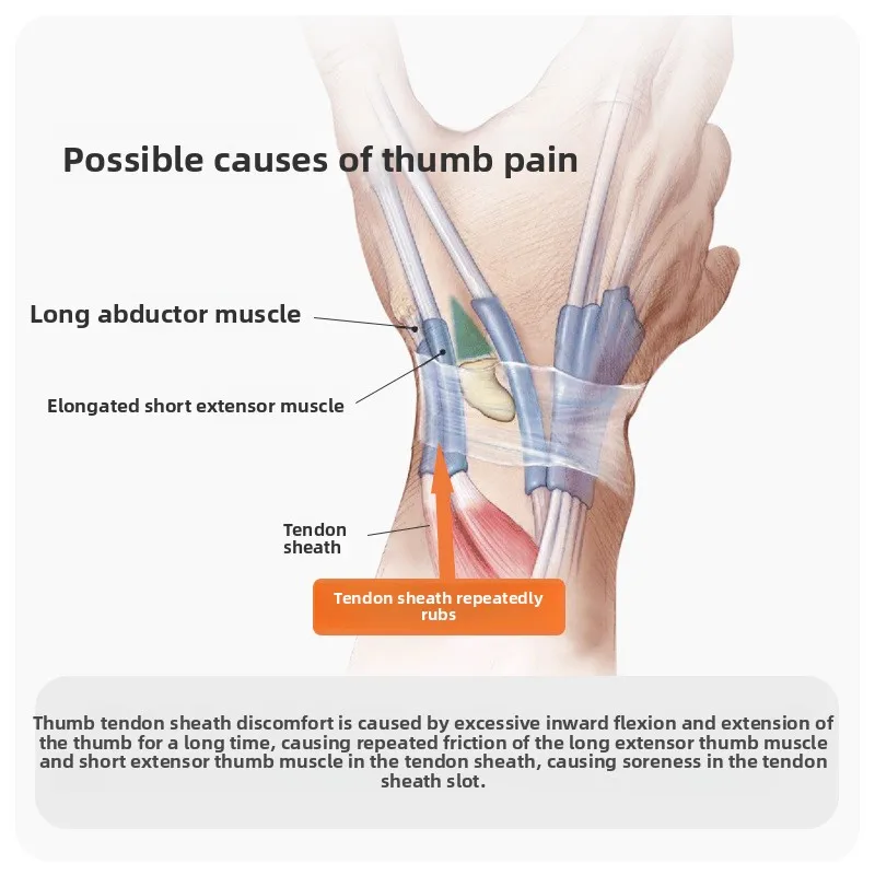 Рисунок 3 - Поддержка запястья и большого пальца