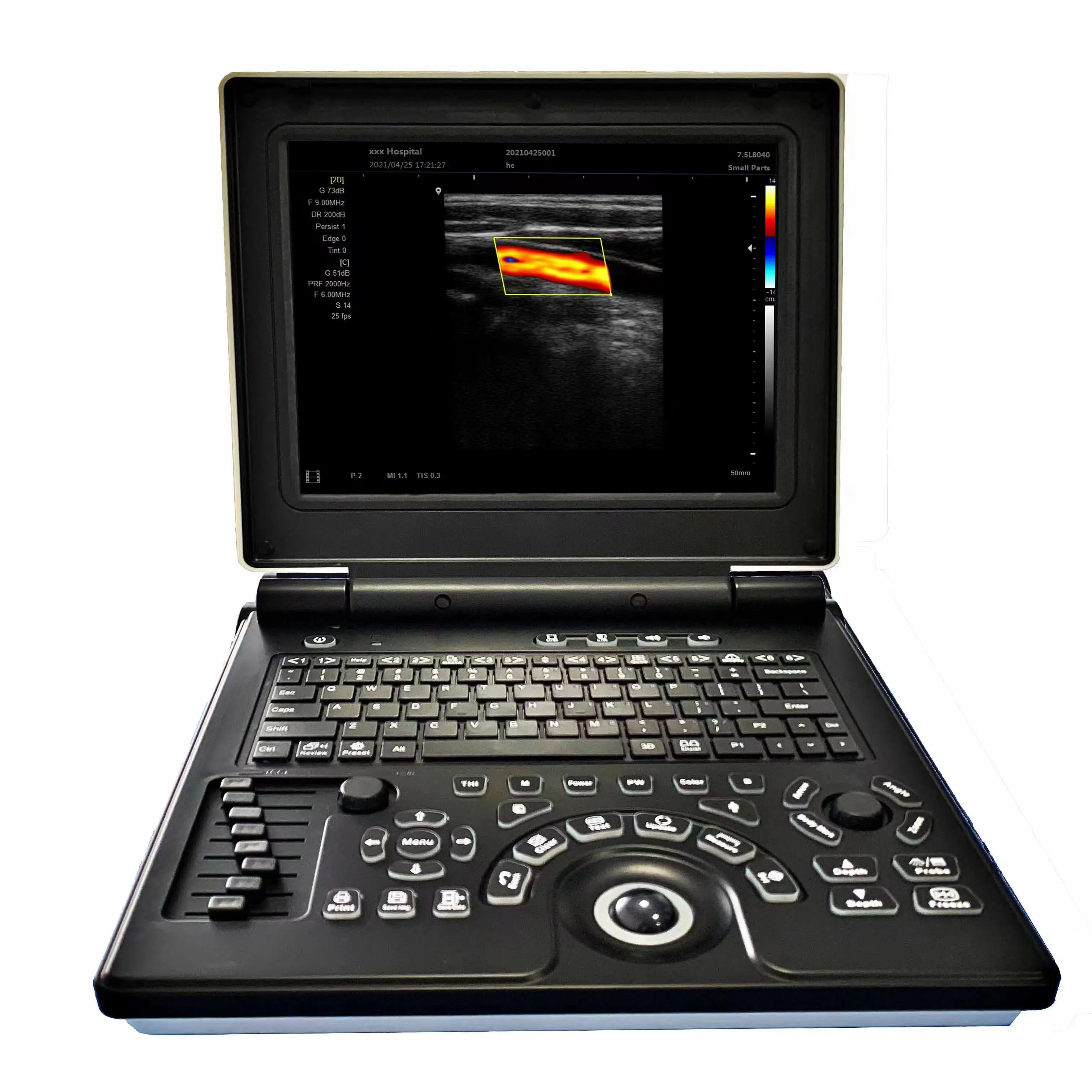 New Arrival Vet Ultrasound Equipment 12 Inch Veterinary Ultrasound Machine Veterinary Ultrasound Scanner