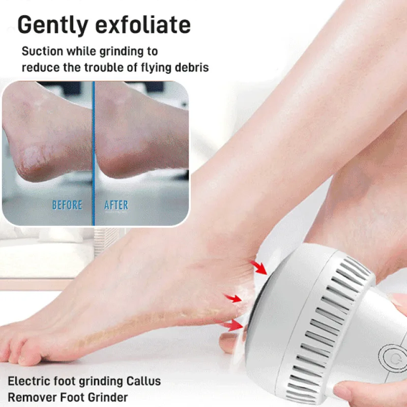 Electric Foot Grinding Artifact Exfoliating Feet Calluses Pedicure Device