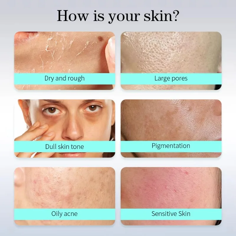 최고급 14 in 1 안티에이징 피부 딥 클렌징 페이셜 보습 미백 주름 제거 페이스 리프팅 뷰티 디바이스