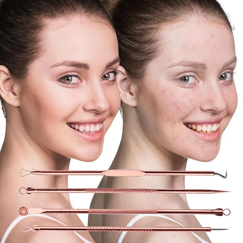 9/7/5 Stuks Acne Mee-Eter Verwijderingsnaalden Kits Roségoud Roestvrij Staal Black Spot Puistje Reinigingstool Gezicht Huidverzorging