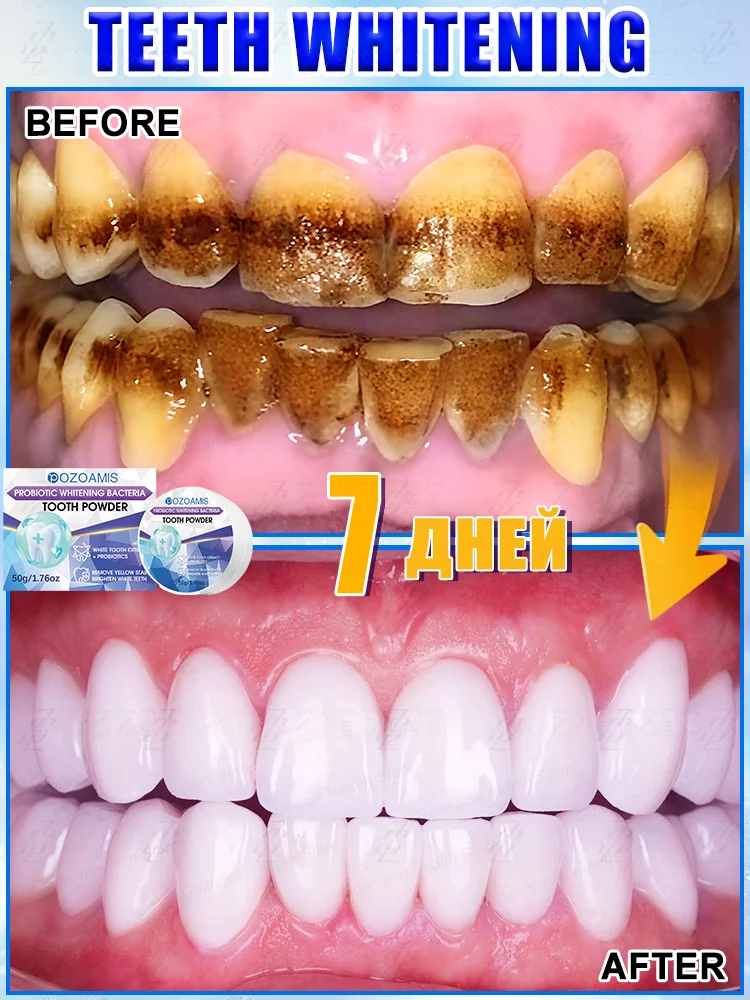 Profesjonalny proszek do wybielania zębów, szybko wybiela zęby i usuwa osad.